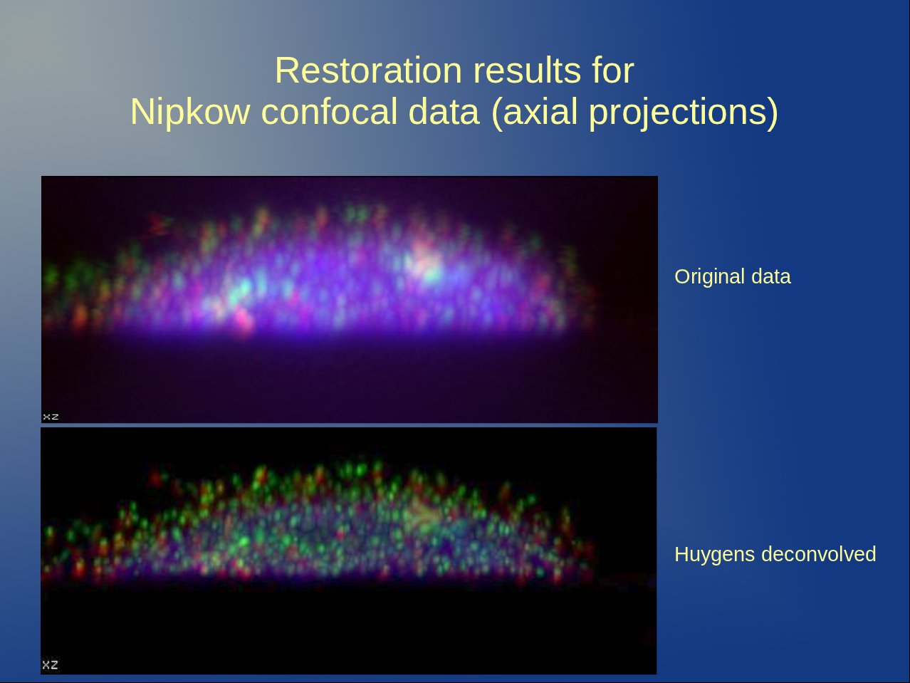 Top picture: XY projections and bottom picture: YZ, XZ projections. Original data as acquired in a Nipkow Disk Microscope shown next to the same image after applying Huygens Deconvolution. The red and green signals are clearly separated much more after the restoration. Calculating colocalization in the original data would have caused fake colocalization levels. Data courtesy Dr. Kozubek, Brno, Czech republic, FP6 3DGenome Project