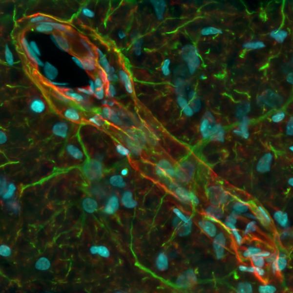 Huygens deconvolved and MIP rendered epifluorescence Z stack of part of a mouse brain. The image shows aquaporin 4 (red) as individual astrocytic end-feet along a blood vessel. Thanks to deconvolution, GFAP (green) can be colocalized with AQ4 in small areas, but the end-feet and arms of astrocytes can be identified as distinguishable structures in terms of protein expression.