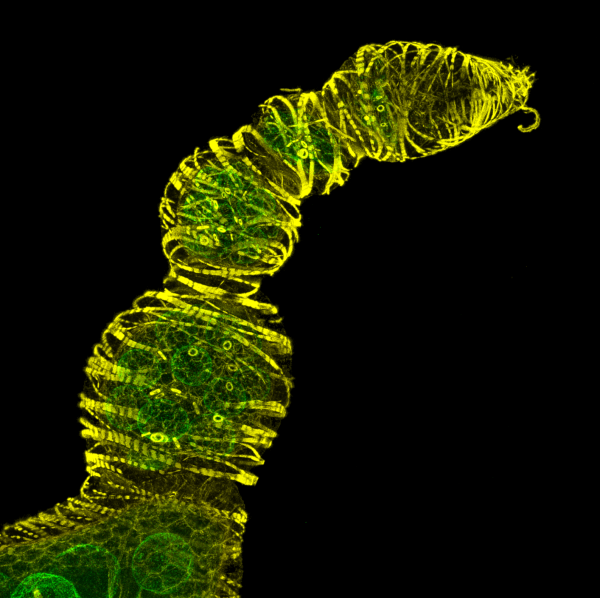 The image represents a Z-stack of 116 sections showing a series of developing Drosophila oocytes with actin in yellow (Phalloidin) and the nuclear envelope of the nurse cells in green (GFP-Tm1).