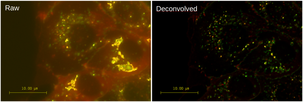 生の 3D 広視野画像（左図）とそのデコンボリューションバージョン（右図）は、Huygens Colocalization Analyzer で解析されています。 デコンボリューションによるぼやけとノイズの除去は、これらの MDCK 細胞の染色された p120 カテニン（赤色）とクローディン（緑色）の間のコロカリゼーションを完全に変更することに注意してください。 コロカリゼーション領域は、等値面レンダリングマップ（ピアソン値に基づく）として黄色で視覚化され、両方のチャネルの MIP に投影されます。 オランダ、Hubrecht Institute、Utrecht の Johan de Rooij 博士の許可を得て使用したデータ。